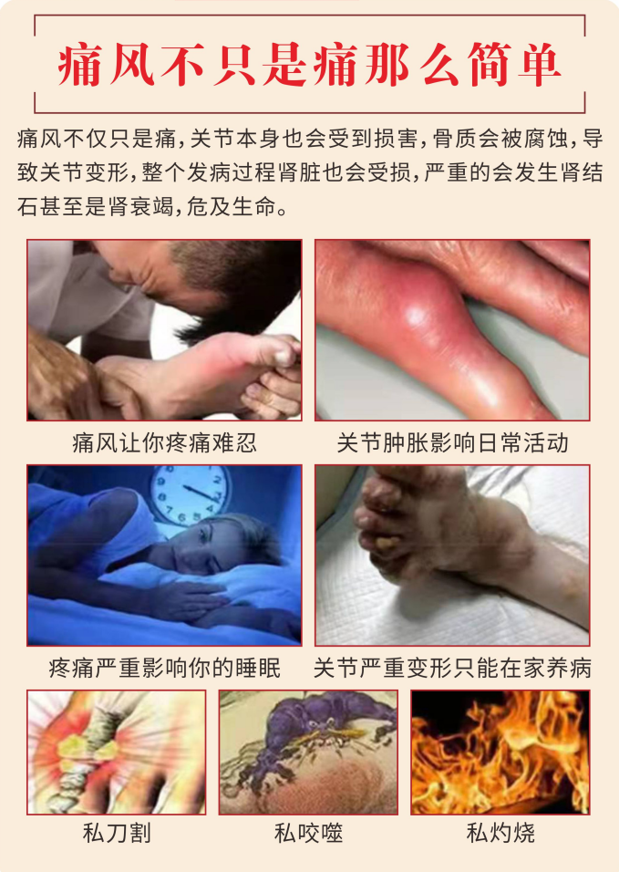 走進(jìn)厚濟(jì)堂制藥有限公司痛風(fēng)膏oem代加工全產(chǎn)業(yè)鏈一站式代工工廠