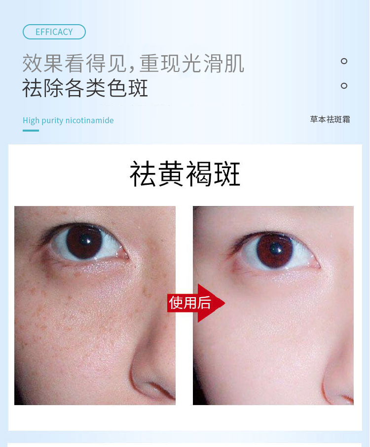 祛斑霜_06.jpg