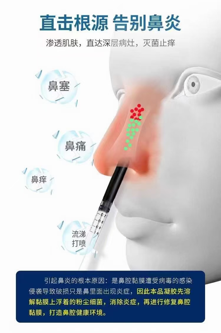 鼻炎噴劑源頭工廠,上百款自主研發(fā)配方滿足你的需求