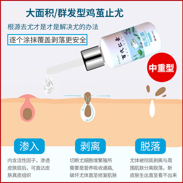 瘊疣平雞尤液OEM代加工