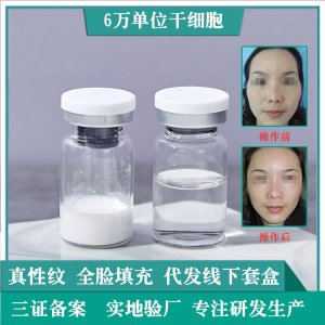 核苷酸干細(xì)胞填充暨大6萬(wàn)單位貼牌定制代加工