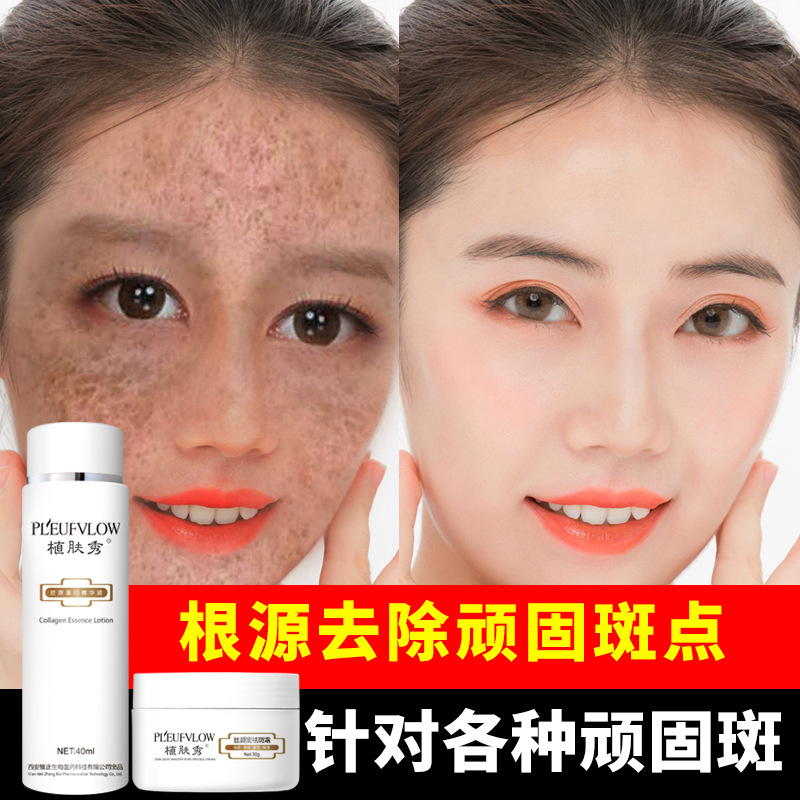 仁和美白祛斑霜淡化色斑男女神器淡斑去斑祛黃褐斑雀斑老年斑正品OEM代加工