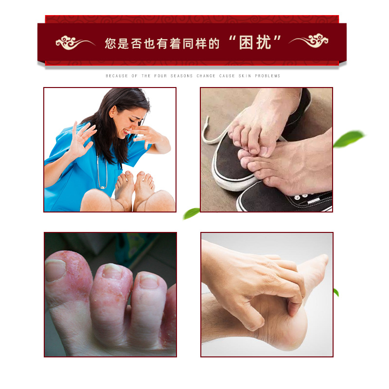 腳部軟膏OEM代加工